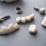 Capsula dente come si fissa