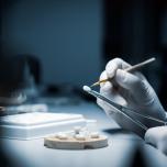 Denti in ceramica o porcellana prezzi