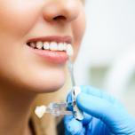 Ricostruzione dente con corona