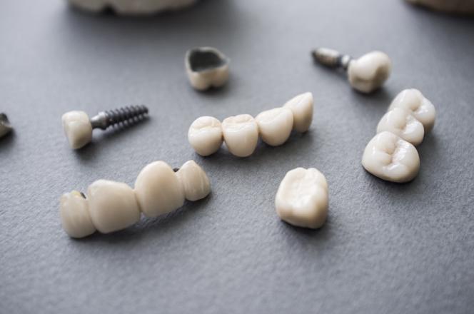 Capsula dente come si fissa Capsula dente come si fissa