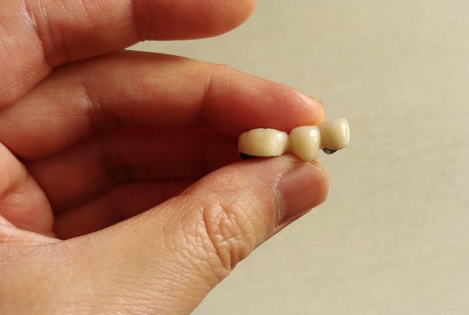 Capsula dente prezzo Capsula dente prezzo