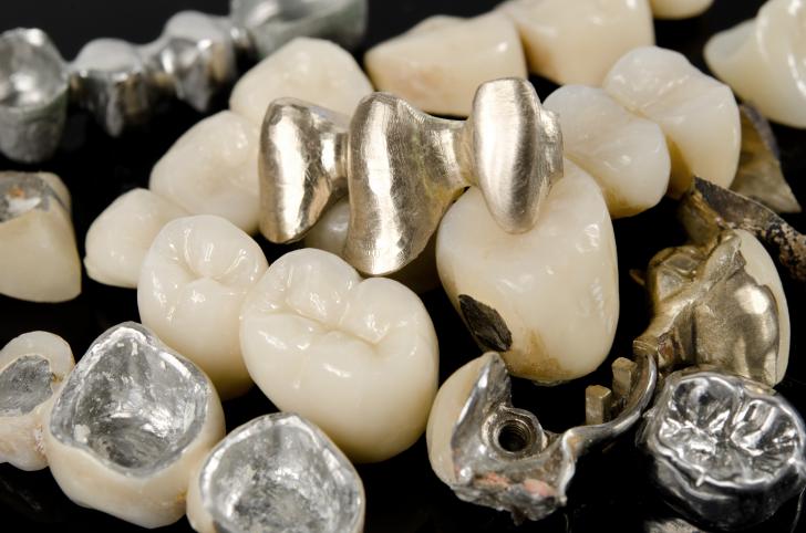 Corona dentale in zirconio Corona dentale in zirconio