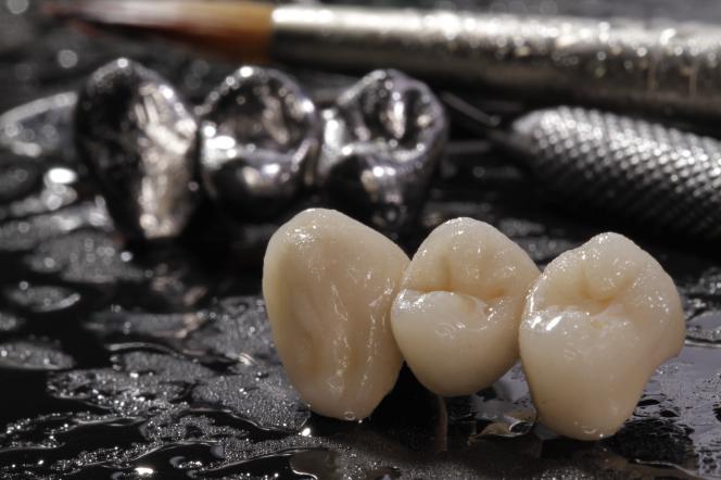 Corona metallo ceramica Corona metallo ceramica