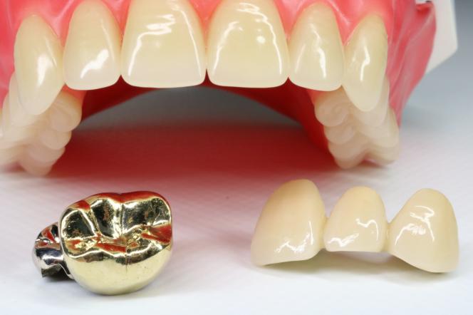 Incapsulare un dente fa male Incapsulare un dente fa male