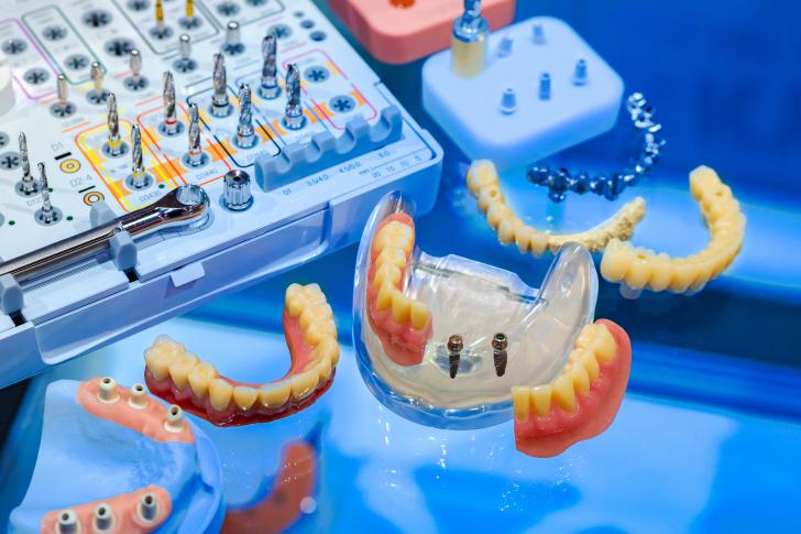 Materiale corona dentale Materiale corona dentale
