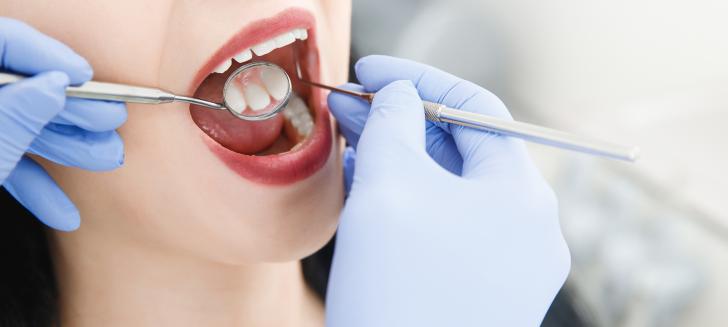 Agenesia dentale faccette Agenesia dentale faccette