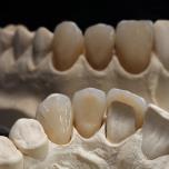Denti finti in farmacia