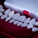Faccette dentali costo