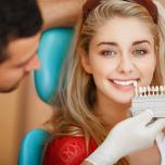 Faccette dentali migliori
