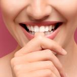 Faccette dentali quanto durano