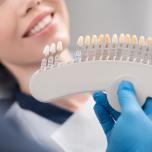 Faccette dentali vip