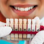 Preparazione faccette dentali