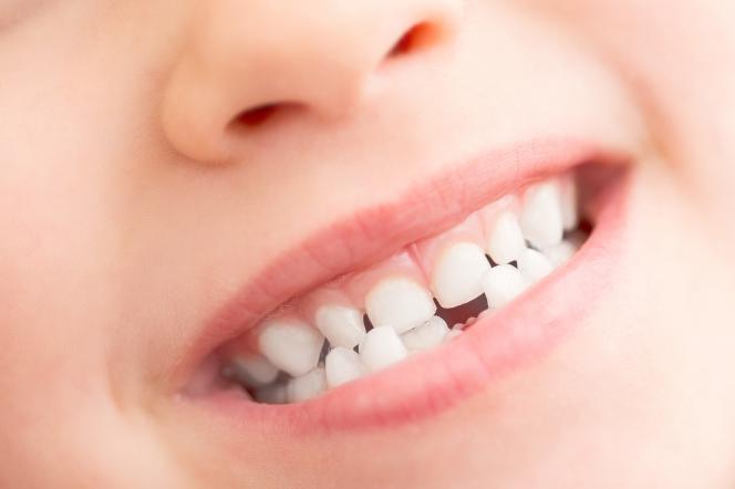 Denti piccoli Denti piccoli