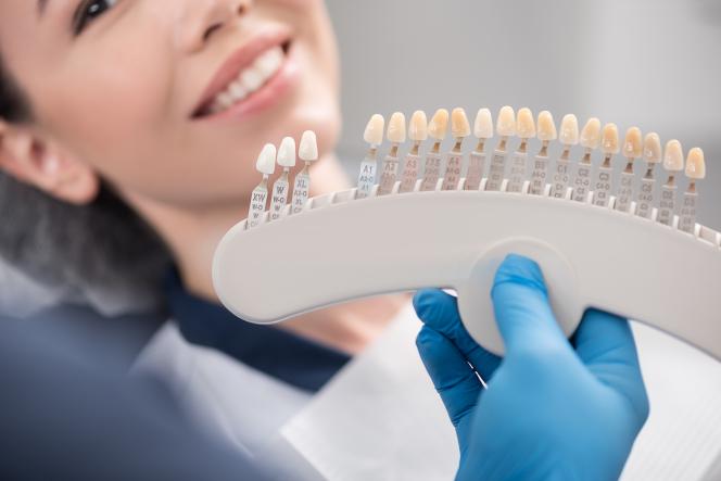Faccette dentali vip Faccette dentali vip