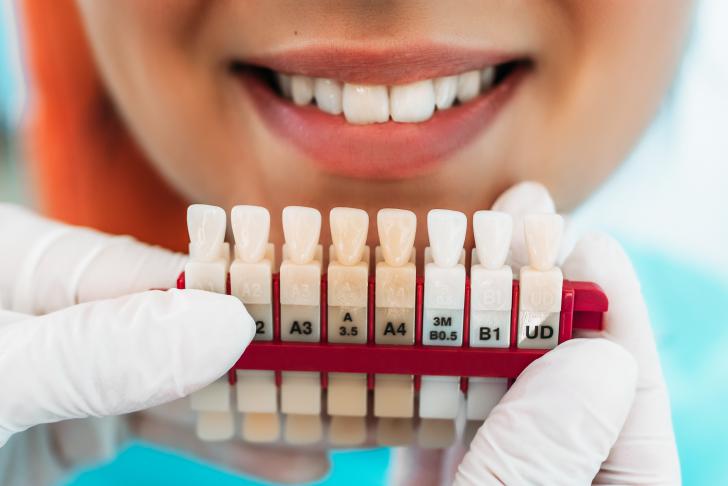 Preparazione faccette dentali Preparazione faccette dentali