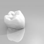 Intarsio dentale o capsula