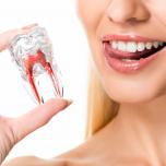 Come sbiancare i denti in 3 minuti