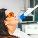 Come sbiancare i denti