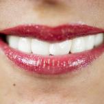 Denti bianchi