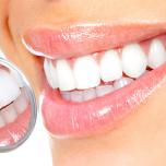 Rimedi per sbiancare i denti