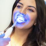 Sbiancamento denti laser