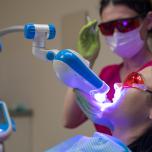 Sbiancamento denti LED