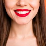 Sbiancamento denti vip