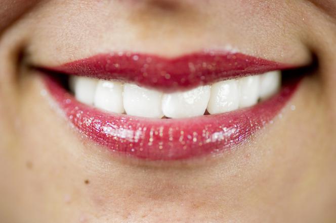 Denti bianchi Denti bianchi