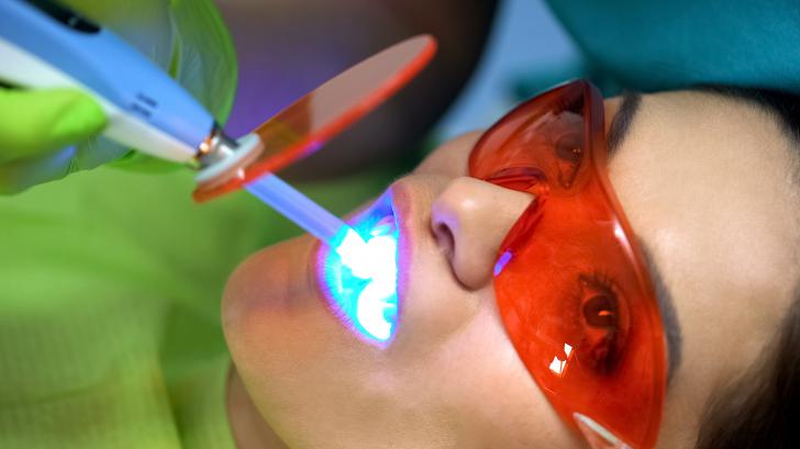 Sbiancamento denti costo Sbiancamento denti costo