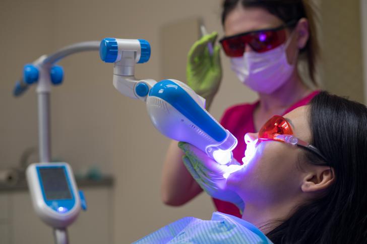 Sbiancamento denti LED Sbiancamento denti LED