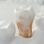 Calcare denti