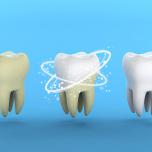 Denti grigi cause