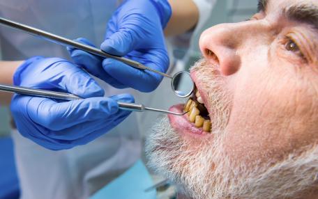Denti arancioni