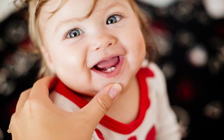 Ipomineralizzazione denti bambini