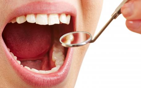 Secchezza delle fauci cause