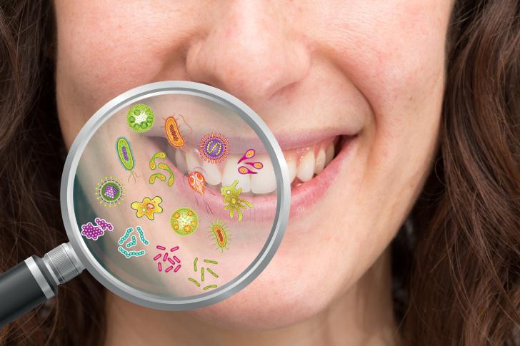 Cosa Succede Se Non Ti Lavi I Denti