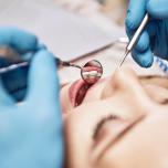 Effetti collaterali pulizia denti