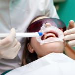 Gel sbiancante denti