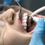 Pulizia dei denti quanto dura