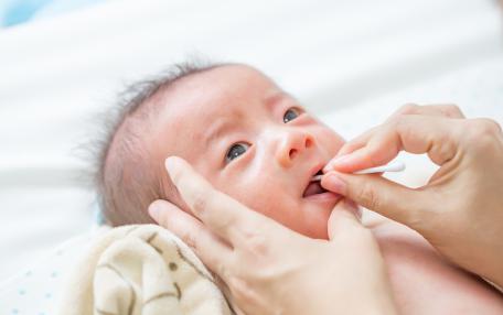 Crema gengive neonati - Quali sono i pricipali vantaggi