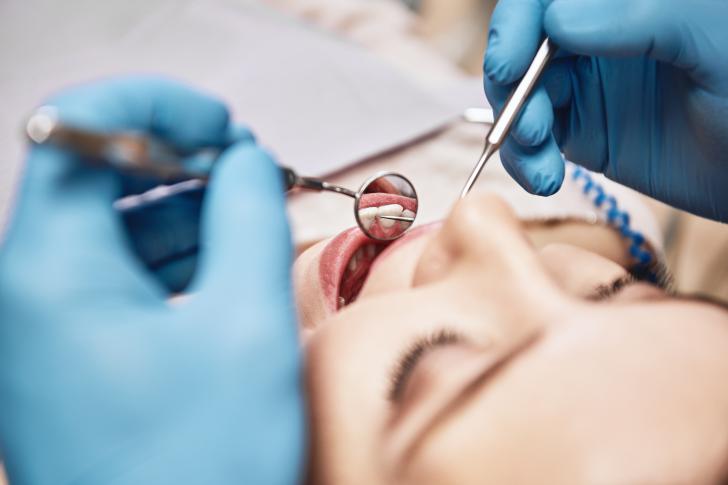 Effetti collaterali pulizia denti Effetti collaterali pulizia denti