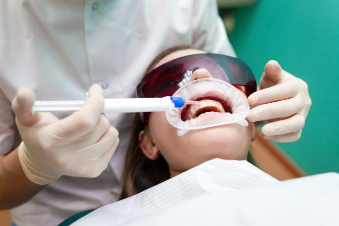 Gel sbiancante denti Gel sbiancante denti