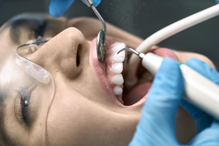 Pulizia dei denti quanto dura Pulizia dei denti quanto dura