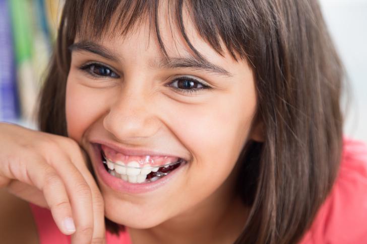 A che età apparecchio denti A che età apparecchio denti