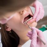 Apparecchio denti adulti