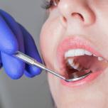 Apparecchio dietro i denti