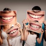 Come raddrizzare i denti storti senza apparecchio
