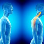 Malocclusione e postura