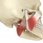 Retrusione mandibolare