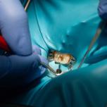 Endodonzia e otturazione